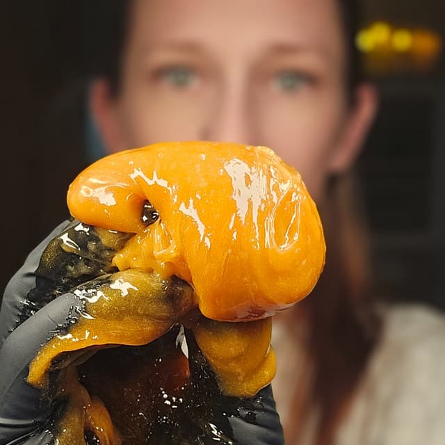 Sugaring Brazilian at Andersen Esthetics LLC in Tonawanda, NY